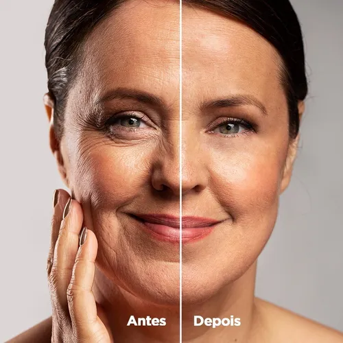 Antes-Depois-Rosa-Mosqueta