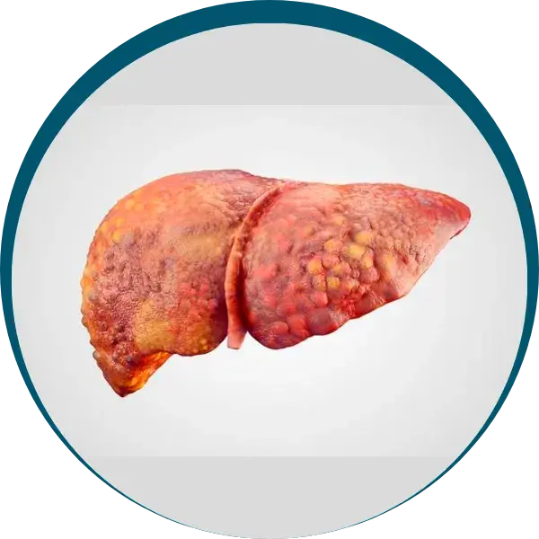 figado