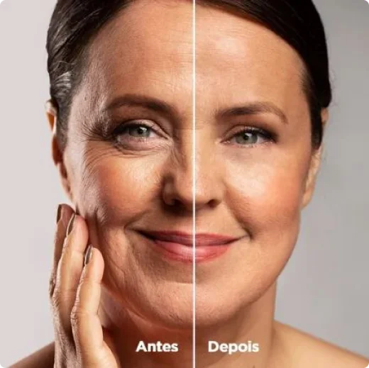 depois.webp