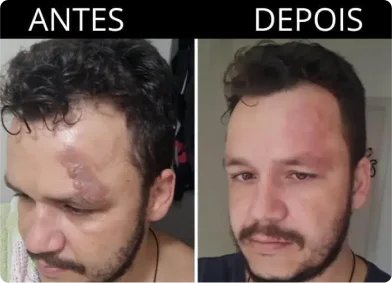 antes e depois beauty-glow-max
