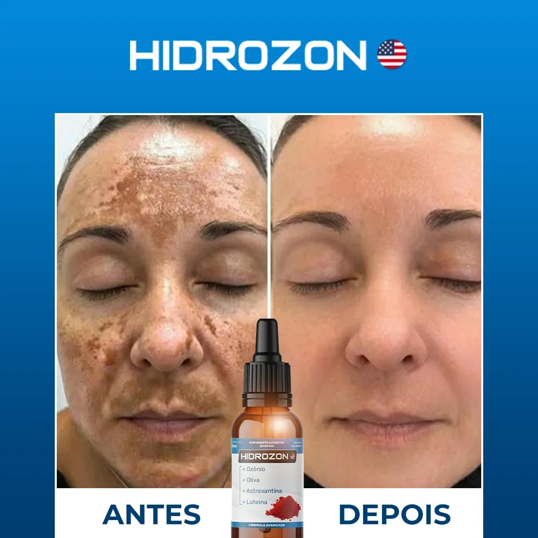 imgi_11_Dep-2