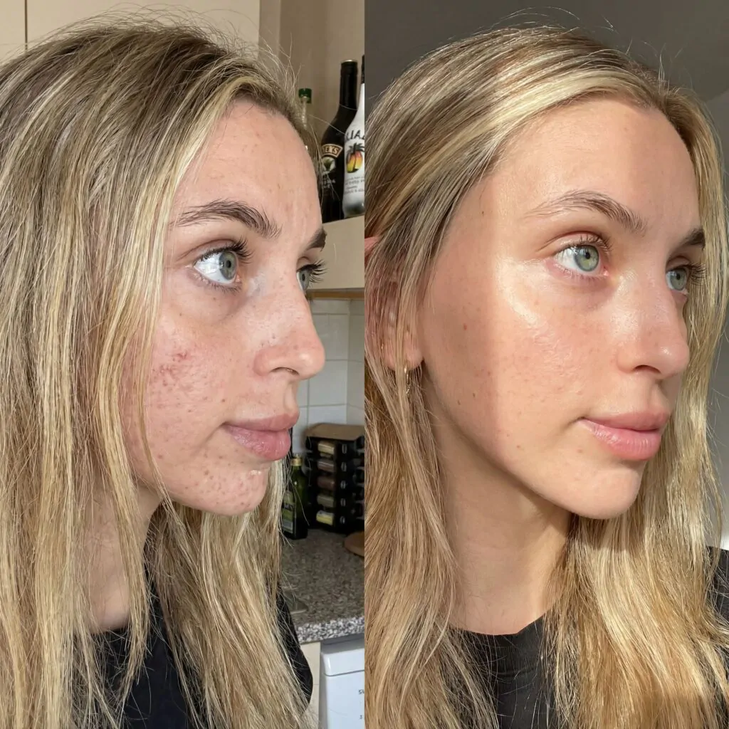 ghk-cu-original-site-oficial ghk-cu original site oficial antes e depois skincare peptídeo de cobre